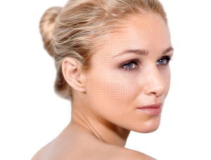 top microneedling services royal palm beach